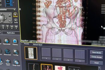 Օդային ճանապարհով քաղաքացին ՀՀ է ներմուծել 845 գրամ  «կոկաին» տեսակի թմրամիջոց