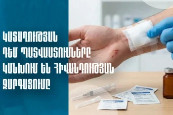 Ի՞նչ անել, եթե կենդանին կծել կամ ճանկռել է, ինչպե՞ս կանխել կատաղության հնարավոր զարգացումը. ԱՆ-ի խորհուրդները